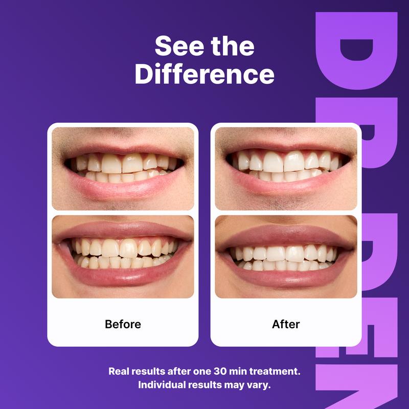 Purple Whitening Strips